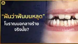 ฝันว่าฟันบนหลุด